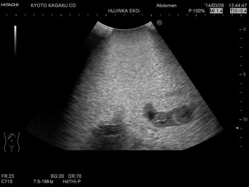 Female Pelvic Ultrasound Phantom | 3-Dmed