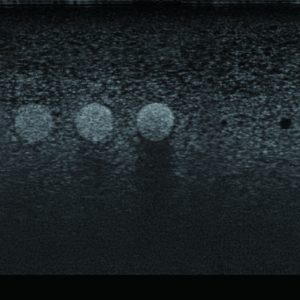 Breast Ultrasound QA Phantom - Image 4