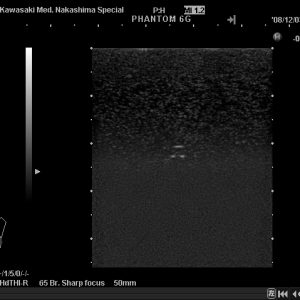 Breast Ultrasound QA Phantom - Image 2