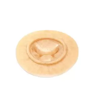 Mitral Valve