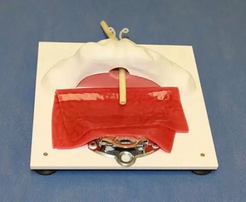 Vesico-Urethral Base - Image 2