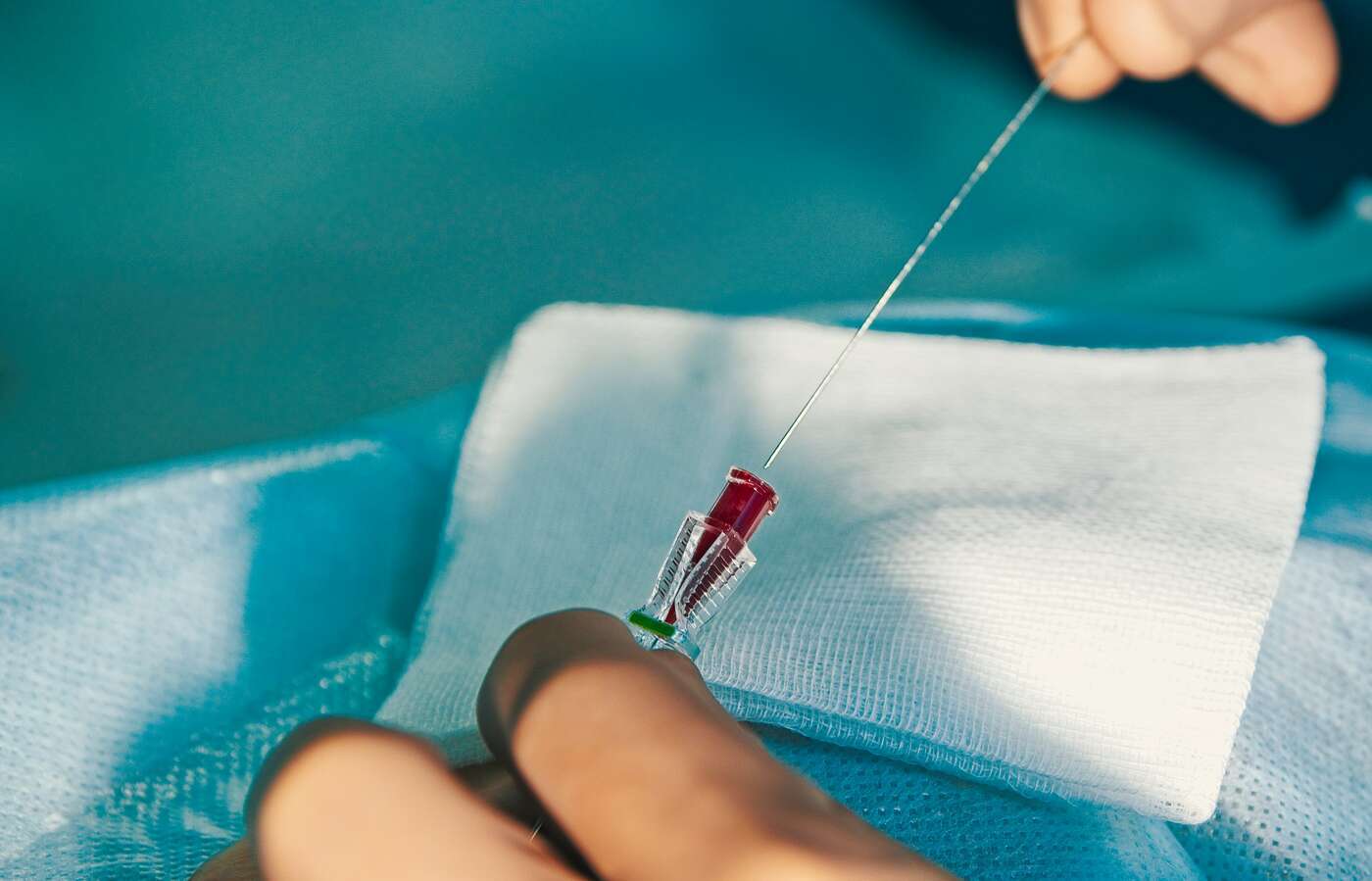Puncture Line Innovations in Arterial Line Training: A Focus on Simulation - 3-D Med